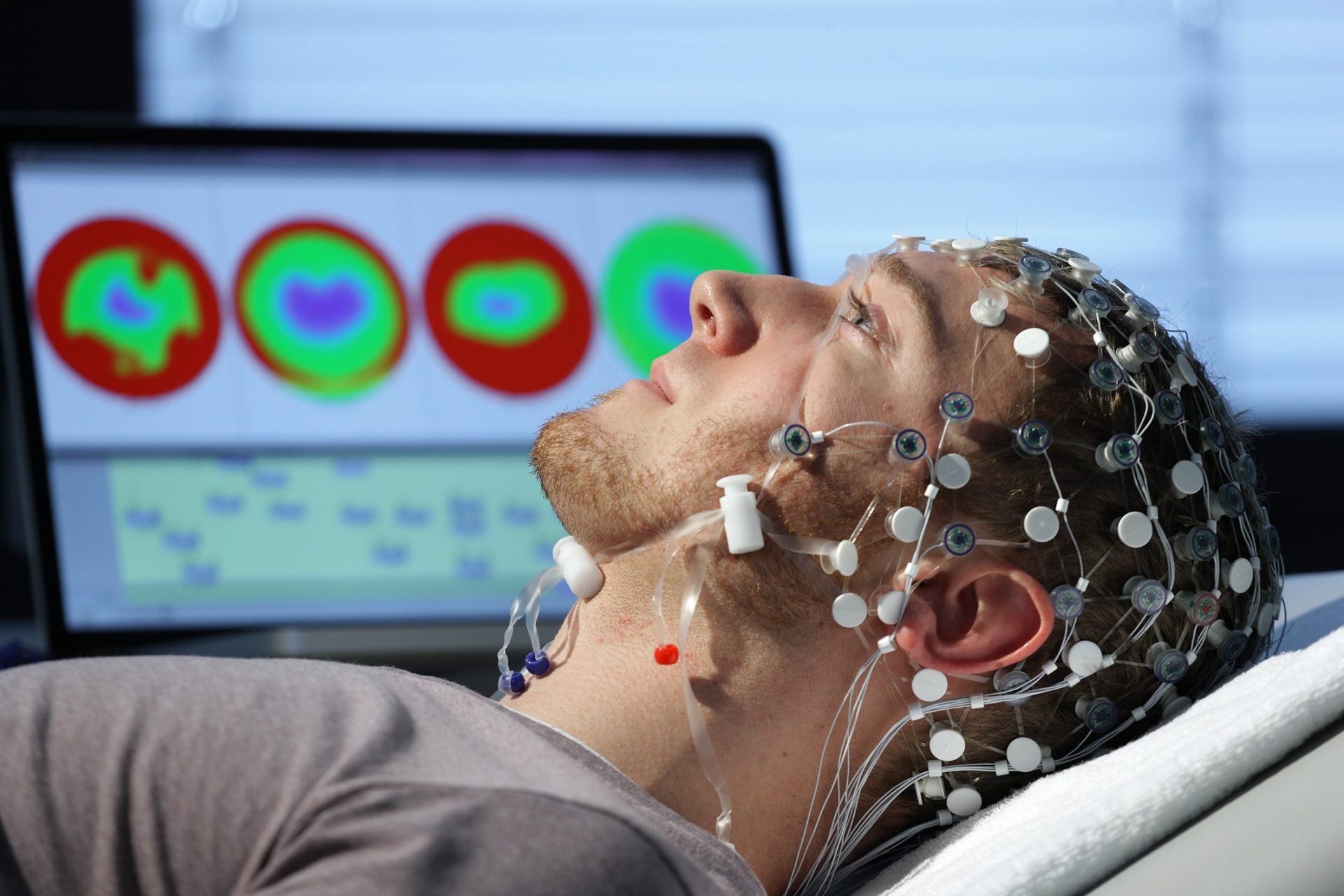 Electroencefalograma Imagen